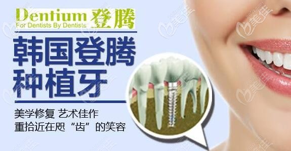 登騰種植牙性?xún)r(jià)比高