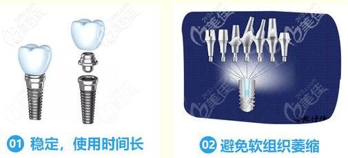 美國(guó)皓圣穩(wěn)定性好，使用壽命更長(zhǎng)久