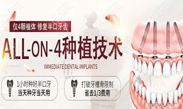 咸陽(yáng)海濤口腔ALL-ON-4種植牙