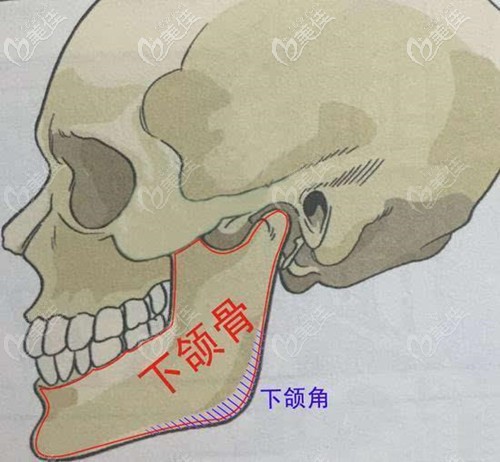 下頜角外翻怎么恢復(fù)