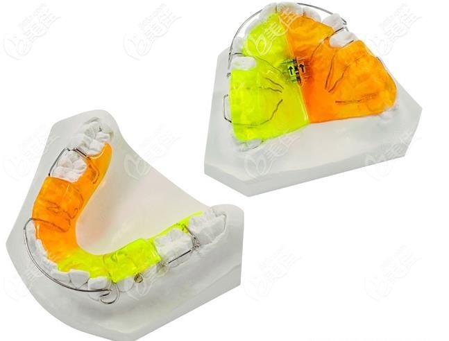 Twin-block矯正器外觀