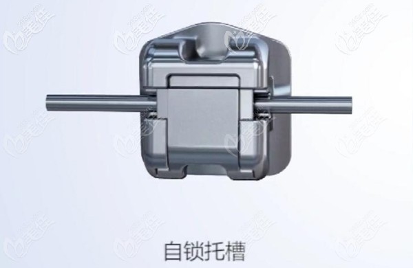 金屬自鎖托槽正畸