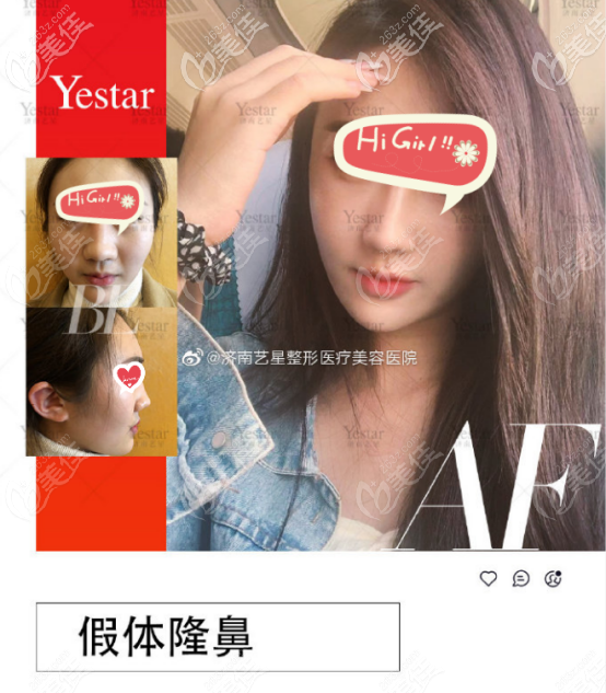 一號求美者案例圖片以及真實(shí)評價 一號求美者案例圖片以及真實(shí)評價