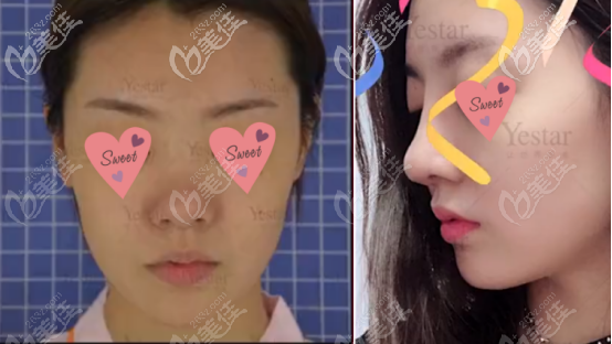 三號求美者案例圖片以及真實(shí)評價 三號求美者案例圖片以及真實(shí)評價