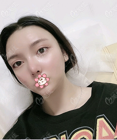 廣州下頜角手術(shù)醫(yī)生推薦<!--<i data=20240703-sp></i>-->