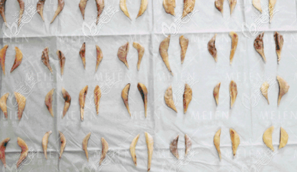 廣東美恩下頜角截骨標(biāo)本