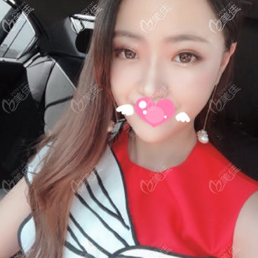 2月10號我來做了全臉脂肪填充,第7天的效果和我想的不一樣