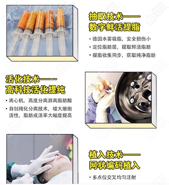 太原時光自體脂肪面部填充優(yōu)勢