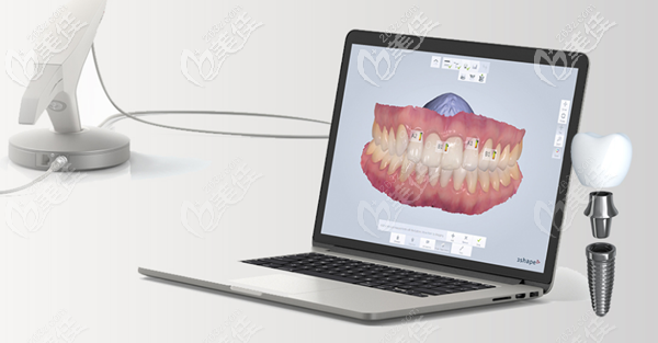 大川的數(shù)字化種植牙技術(shù)