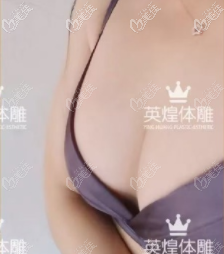 親身體驗項力源豐胸技術(shù)還蠻好的