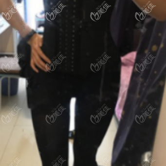 做威塑腰腹環(huán)吸術(shù)后痛感還是比較輕的