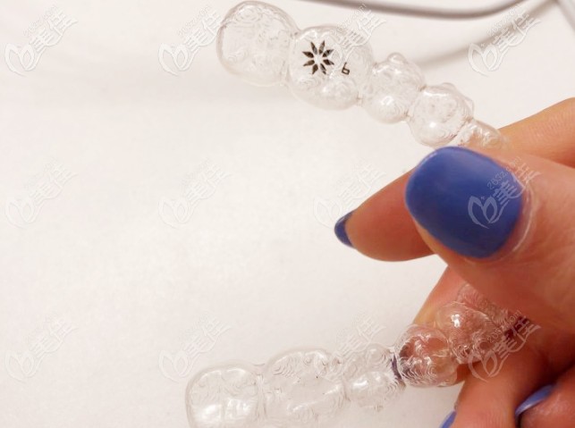 我的隱適美牙套 我的隱適美牙套