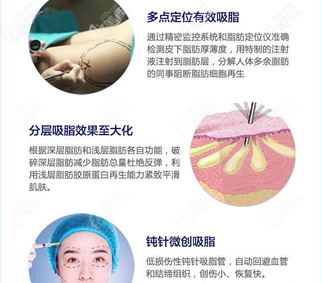 從技術(shù)優(yōu)勢了解太原時光吸脂怎么樣