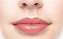 北京做人中縮短手術(shù)費(fèi)用是多少?在上美整形做人中縮短術(shù)約4980元起