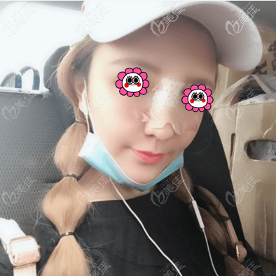 找北京王勛做鼻子有4天了