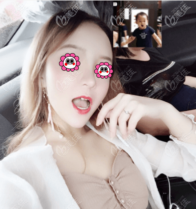 說北京王勛隆鼻好原因是我做的網(wǎng)紅風隆鼻效果喜歡呢