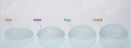 韓國(guó)魔滴假體反饋比較高