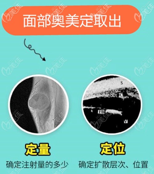 <!--<i data=20240703-sp></i>-->時光包濤院長面部奧美定取出 <!--<i data=20240703-sp></i>-->時光包濤院長面部奧美定取出