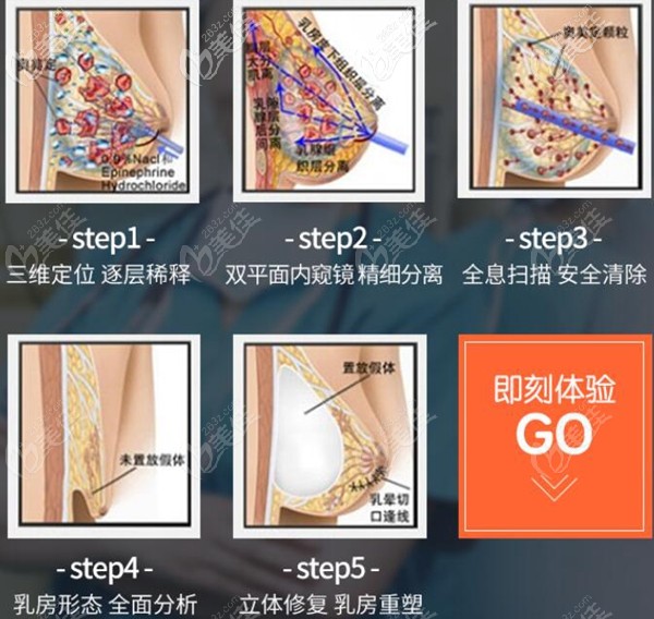 武漢仁愛時光包濤院長胸部奧美定取出 武漢仁愛時光包濤院長胸部奧美定取出