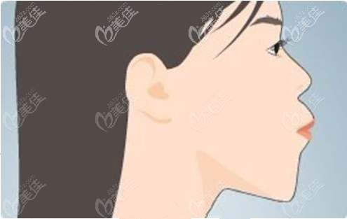 <!--<i data=20240703-sp></i>-->正頜手術(shù)怎么樣？