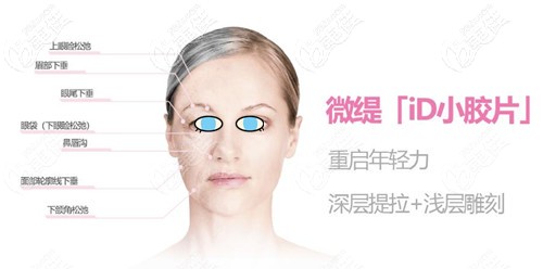 微提id小膠片治療部位