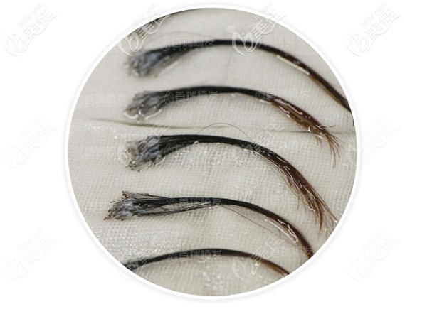 完全不剃發(fā)長(zhǎng)發(fā)種植效果