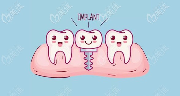 種植牙