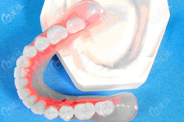 沈陽(yáng)鑲牙多少錢(qián)一顆