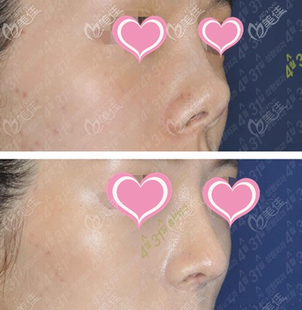 金載勛431鼻部案例