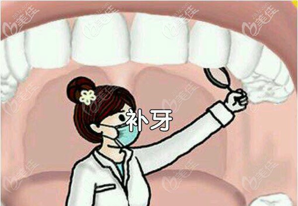 補(bǔ)牙的材料決定了費(fèi)用 補(bǔ)牙的材料決定了費(fèi)用