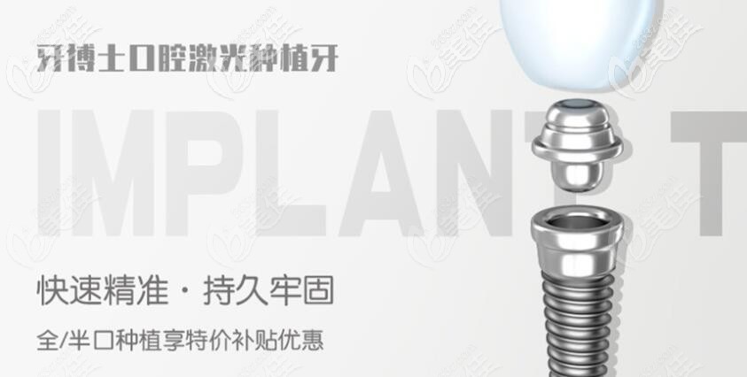 牙博士口腔種植牙技術(shù)精準(zhǔn)