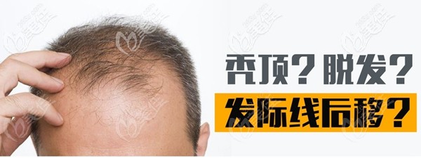 恩施植發(fā)好的醫(yī)院推薦恩施美年華