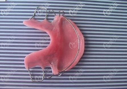 平導(dǎo)矯正器實(shí)圖