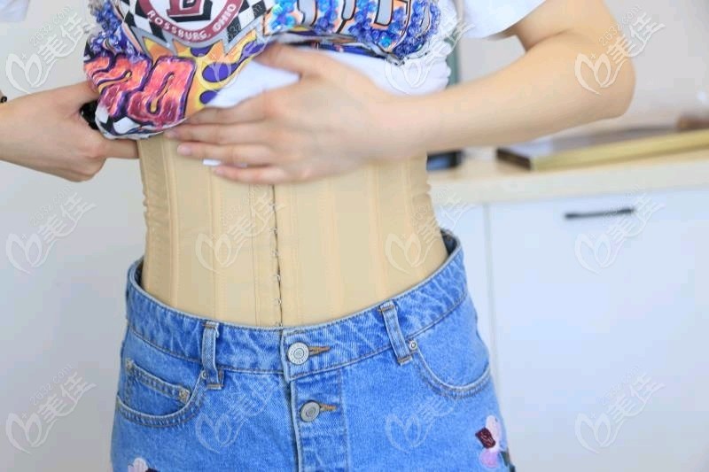 <!--<i data=20240703-sp></i>-->魔力塑腰腹吸脂半個月恢復(fù)效果圖