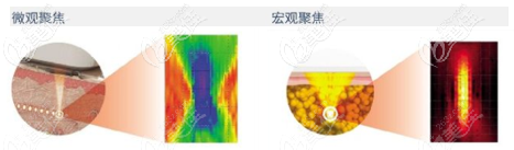 7d聚拉提和熱瑪吉的區(qū)別技術(shù)之間有差異