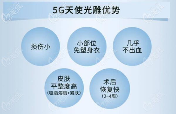 5G天使光雕的優(yōu)勢有哪些 5G天使光雕的優(yōu)勢有哪些