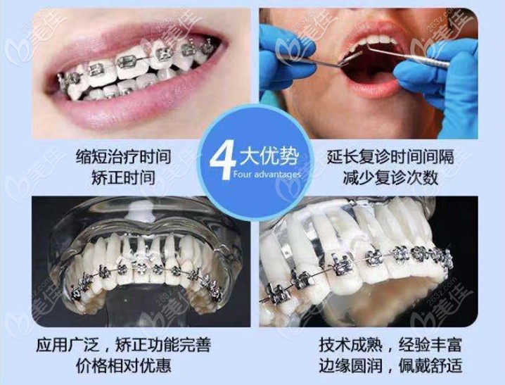 金屬矯正器的4大優(yōu)勢 金屬矯正器的4大優(yōu)勢