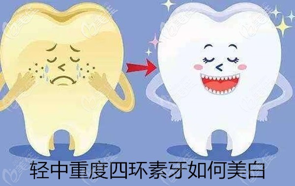 輕中重度四環(huán)素牙如何美白