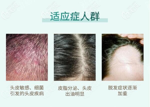 洗發(fā)水品牌排行榜前十名