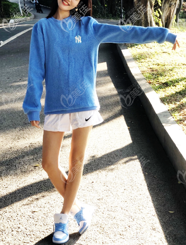 曹孟君土麥森吸脂技術太厲害了,我的土麥森大腿吸脂術后恢復效果就是證明