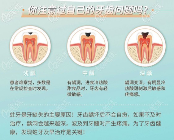 蛀牙后齲齒的分類
