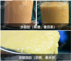 濃縮脂肪示意圖 濃縮脂肪示意圖