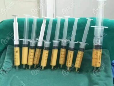 沈陽自體脂肪填充做得好的醫(yī)生都有誰 沈陽自體脂肪填充做得好的醫(yī)生都有誰