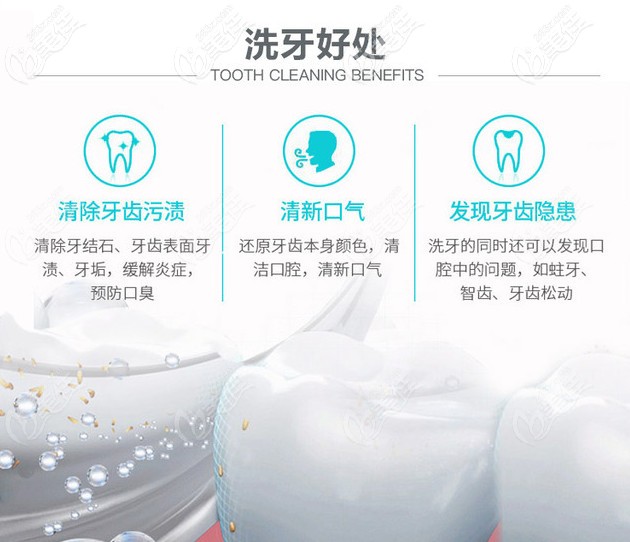 北京勁松口腔洗牙的好處