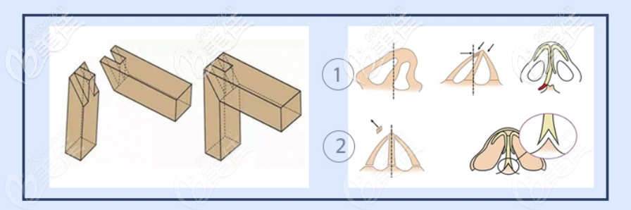 <!--<i data=20240703-sp></i>-->醫(yī)療美容門診部鼻部整形 <!--<i data=20240703-sp></i>-->醫(yī)療美容門診部鼻部整形