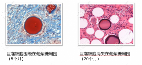 葡聚多肽細(xì)胞填充面部好不好？性怎么樣？