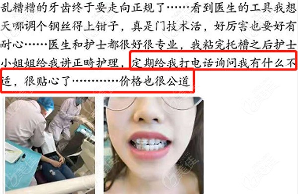 護(hù)士會(huì)定期回訪