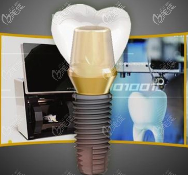 以色列科特斯cortex種植系統(tǒng)