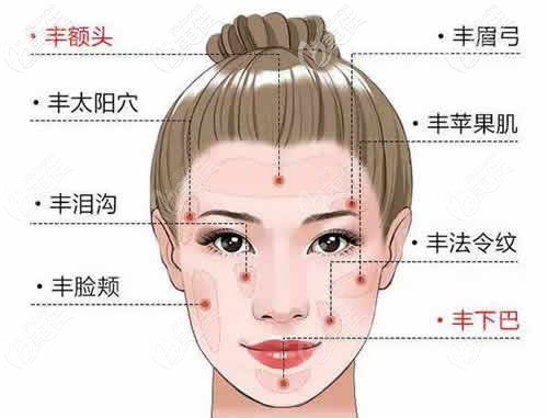 面部脂肪填充的部位分布圖 面部脂肪填充的部位分布圖