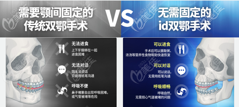 韓國(guó)雙顎手術(shù)比國(guó)內(nèi)正頜技術(shù)更先進(jìn)